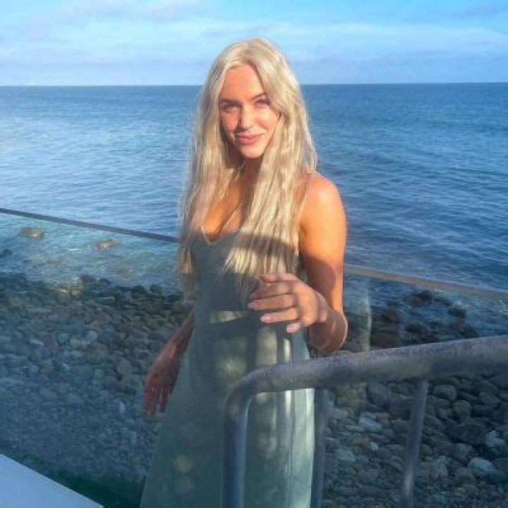 Alex Cooper Denied Plastic Surgery Rumors