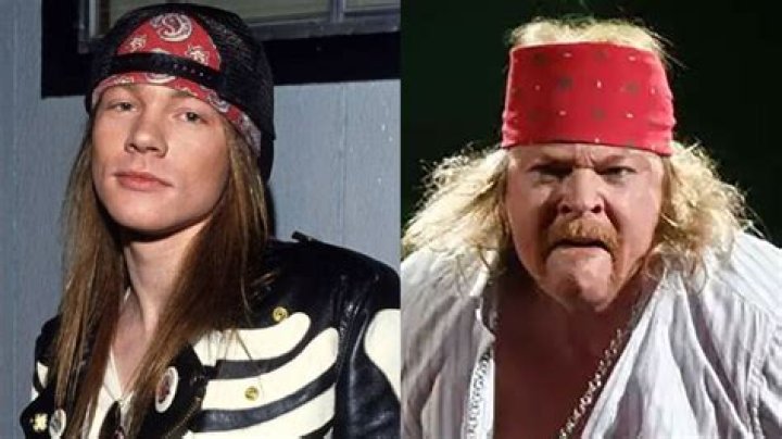 Axl Rose’s Plastic Surgery: The Guns N’ Roses Star Looks Unnatural!