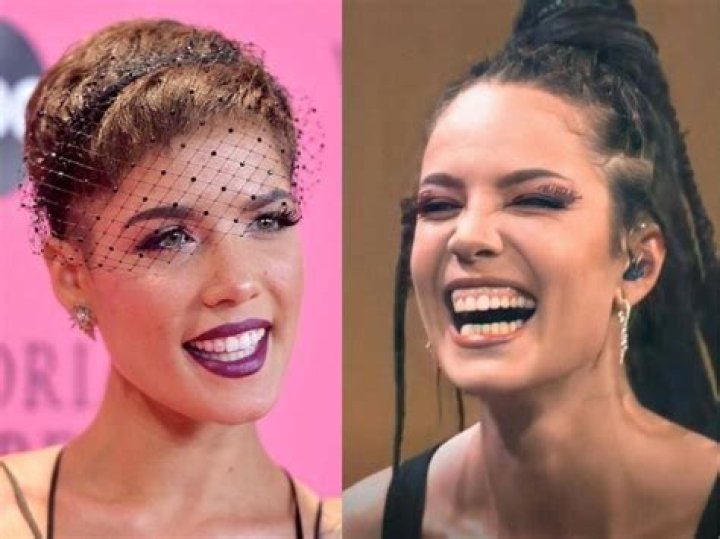 Before And After Photos Of Roberto Firmino Teeth- Explore His New Looks