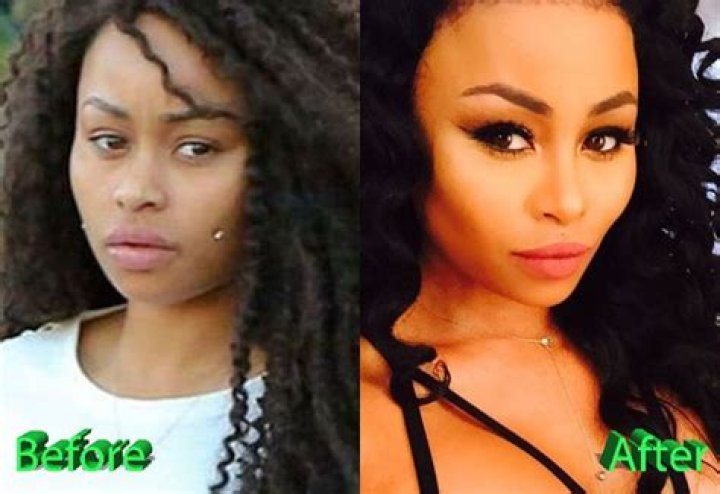 Blac Chyna’s Before And After Transformation: Explained