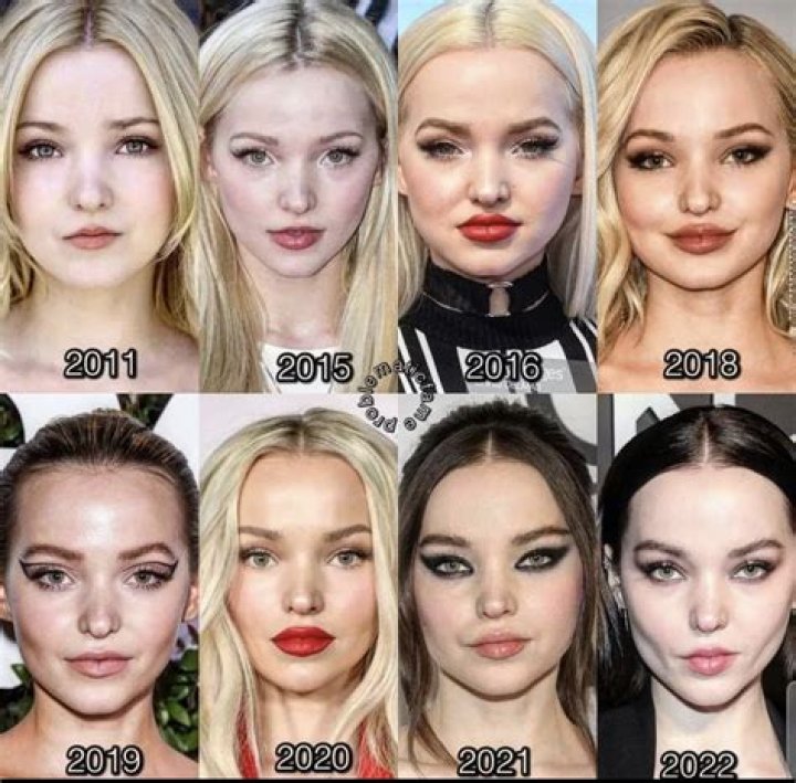 Dove Cameron Weight Loss Reason; Before And After photos