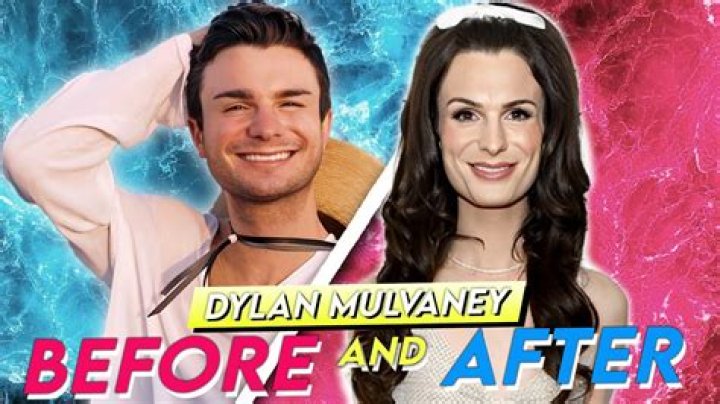 Dylan Mulvaney Weight Loss Before And After: Plastic Surgery And Transformation