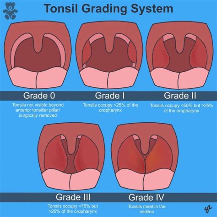 Eiichiro Oda Illness And Health Update 2023: Is he Sick With Peritonsillar Abscess?