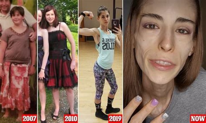 Hannah Murray’s Health Has Fans Worried After Anorexia -What’s Happened To Her?