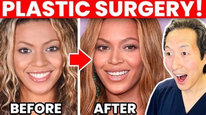 Has Beyonce Had A Nose Job or Plastic Surgery?