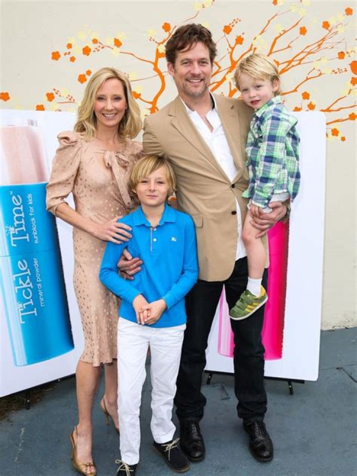 
Is Anne Heche Dead? James Tupper Wife Death Update – Accident Details Explored 
