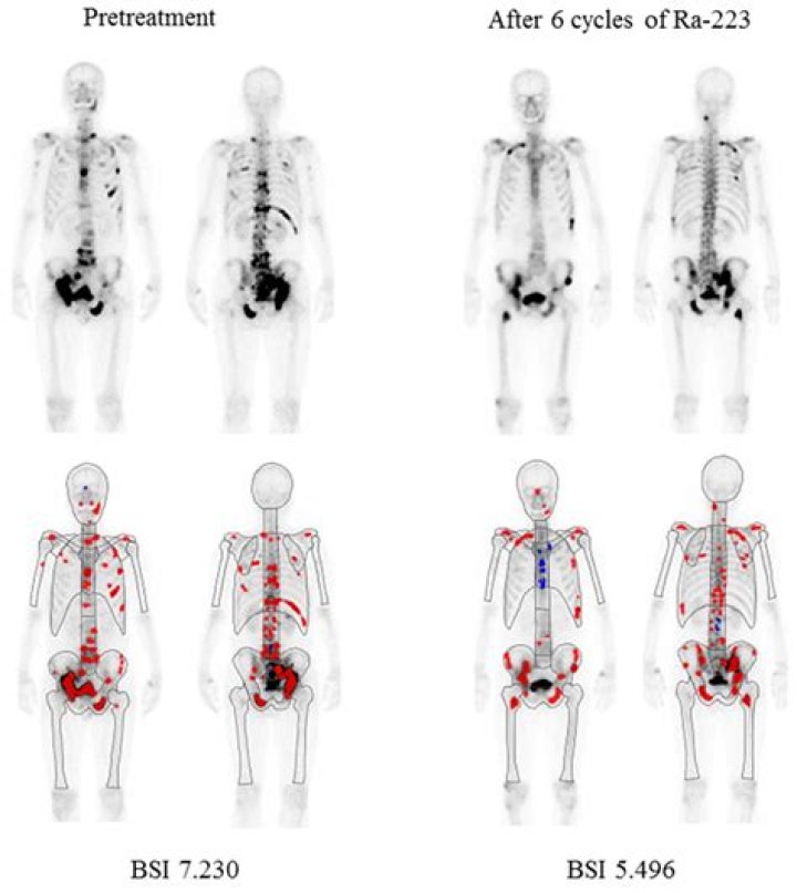 Is Derek Chauvin Still Alive? What's the Current Status of Derek Chauvin? Any Updates on Derek Chauvin's Well-being? Where is Derek Chauvin Incarcerated? - SarkariResult