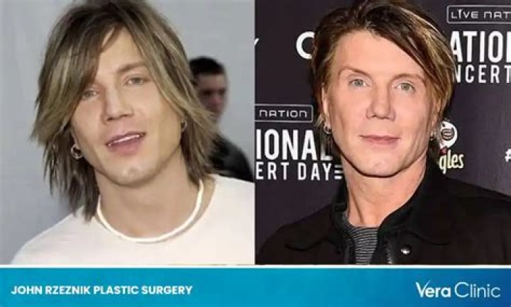 Johnny Rzeznik Plastic Surgery : Separating Rumors from Facts - SarkariResult