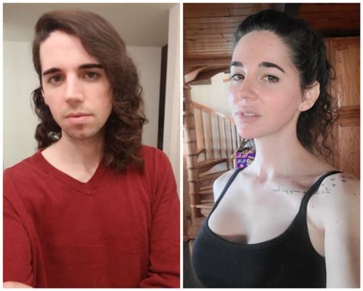 Sasha Allen and Her Transgender Surgery Story, Have A Look At Before and After Transition Pictures