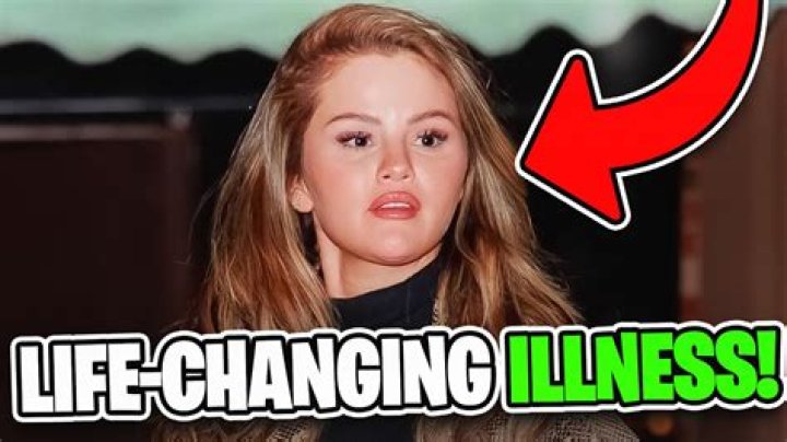 Selena Gomez's Voice Transformation: Understanding Changes and Possible Reasons - SarkariResult