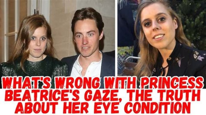 What Eye Disease Does Princess Beatrice Have? Has She Done A Surgery? Health Update