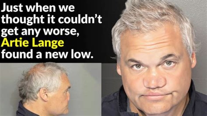 What happened to Artie Lange’s nose? Did Artie Lange get his nose fixed?