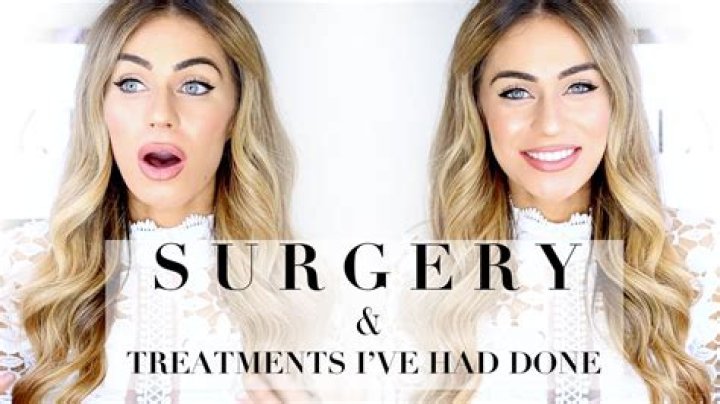 
What Surgery Did YouTuber Lydia Millen Have? 